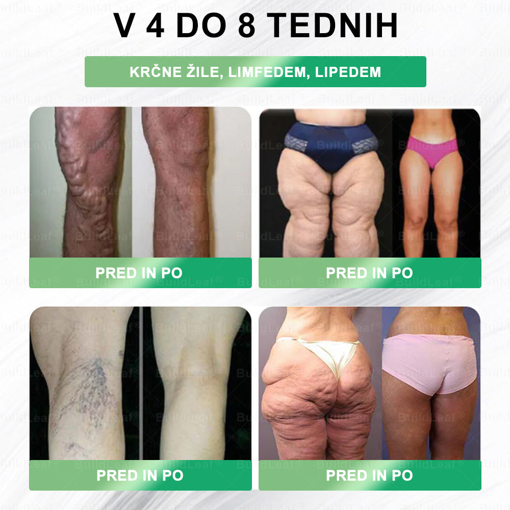 🍐BuildLeaf® GLP-1 8-v-1 Fit & Vital Řešení ✅ Obezita, kardiovaskulární zdraví, cukrovka, spánková apnoe, zdraví střev, problémy se klouby a další.